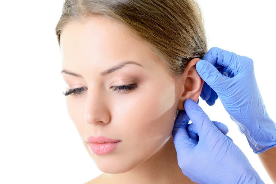 Otoplastica